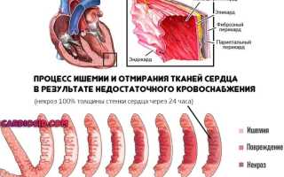 Милдронат после инсульта
