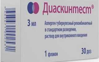 Диаскинтест: что это такое и для чего его приводят?