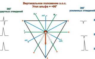 Синусовая аритмия и вертикальное положение эос