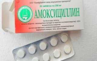 Чем заменить Амоксициллин? Аналоги
