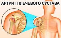 Температура 38 после инфаркта