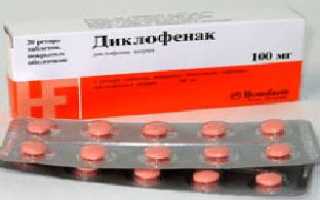 Диклофенак таблетки — от чего помогают?
