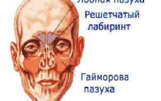 Гайморит: причины, методы лечения