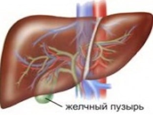 Как лечить холецистит народными средствами