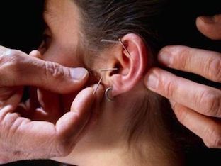 Применение точек для похудения на теле, ухе, Су Джок
